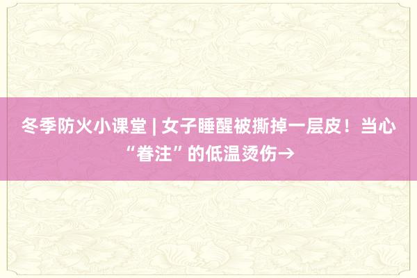 冬季防火小课堂 | 女子睡醒被撕掉一层皮！当心“眷注”的低温烫伤→